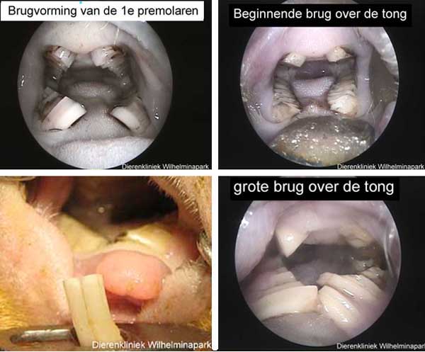 Door vitamine C tekort ontstaat een brug van de kiezen over de tong
